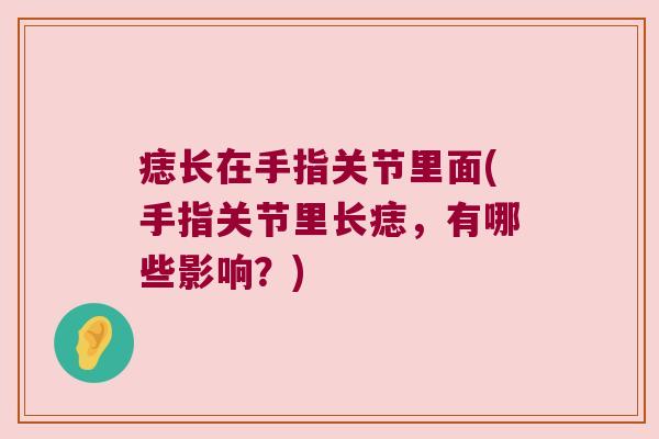 痣长在手指关节里面(手指关节里长痣，有哪些影响？)