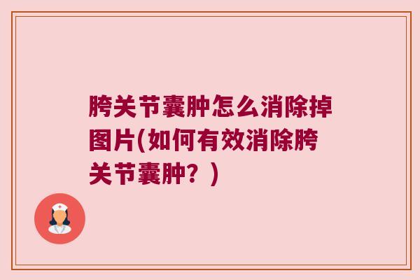 胯关节囊肿怎么消除掉图片(如何有效消除胯关节囊肿？)
