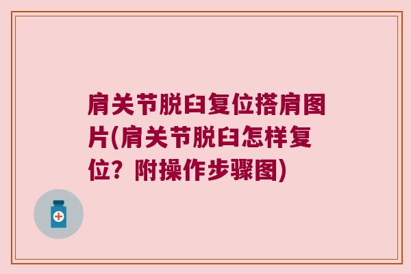 肩关节脱臼复位搭肩图片(肩关节脱臼怎样复位?附操作步骤图) 肩关节脱臼复位搭肩图片(肩关节脱臼怎样复位?附操作步骤图)