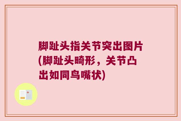 脚趾头指关节突出图片(脚趾头畸形,关节凸出如同鸟嘴状) 脚趾头指关节突出图片(脚趾头畸形,关节凸出如同鸟嘴状)