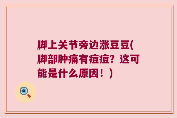 脚上关节旁边涨豆豆(脚部肿痛有痘痘?这可能是什么原因!) 脚上关节旁边涨豆豆(脚部肿痛有痘痘?这可能是什么原因!)