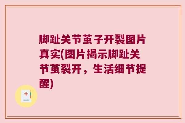 脚趾关节茧子开裂图片真实(图片揭示脚趾关节茧裂开,生活细节提醒) 脚趾关节茧子开裂图片真实(图片揭示脚趾关节茧裂开,生活细节提醒)