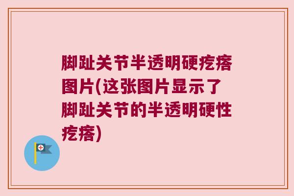 脚趾关节半透明硬疙瘩图片(这张图片显示了脚趾关节的半透明硬性疙瘩) 脚趾关节半透明硬疙瘩图片(这张图片显示了脚趾关节的半透明硬性疙瘩)