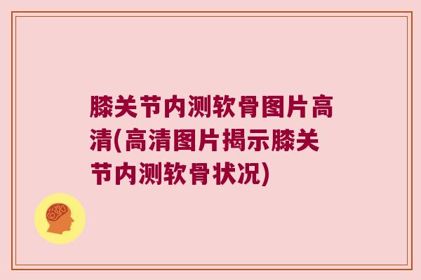 膝关节内测软骨图片高清(高清图片揭示膝关节内测软骨状况) 膝关节内测软骨图片高清(高清图片揭示膝关节内测软骨状况)