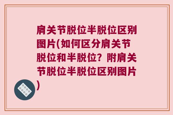 肩关节脱位半脱位区别图片(如何区分肩关节脱位和半脱位?附肩关节脱位半脱位区别图片) 肩关节脱位半脱位区别图片(如何区分肩关节脱位和半脱位?附肩关节脱位半脱位区别图片)