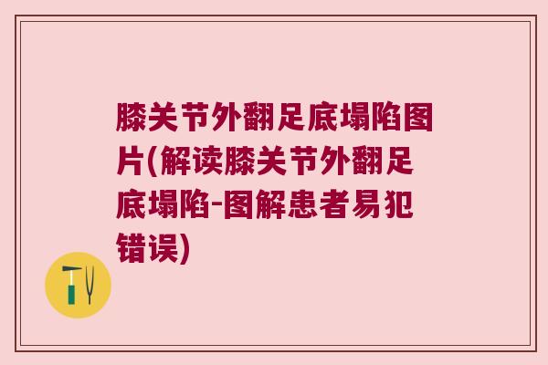 膝关节外翻足底塌陷图片(解读膝关节外翻足底塌陷-图解患者易犯错误) 膝关节外翻足底塌陷图片(解读膝关节外翻足底塌陷-图解患者易犯错误)