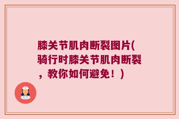 膝关节肌肉断裂图片(骑行时膝关节肌肉断裂,教你如何避免!) 膝关节肌肉断裂图片(骑行时膝关节肌肉断裂,教你如何避免!)