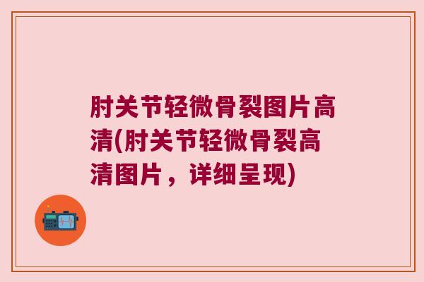 肘关节轻微骨裂图片高清(肘关节轻微骨裂高清图片,详细呈现) 肘关节轻微骨裂图片高清(肘关节轻微骨裂高清图片,详细呈现)