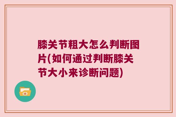 膝关节粗大怎么判断图片(如何通过判断膝关节大小来诊断问题) 膝关节粗大怎么判断图片(如何通过判断膝关节大小来诊断问题)