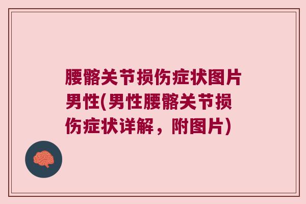 腰髂关节损伤症状图片男性(男性腰髂关节损伤症状详解，附图片)