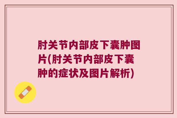 肘关节内部皮下囊肿图片(肘关节内部皮下囊肿的症状及图片解析) 肘关节内部皮下囊肿图片(肘关节内部皮下囊肿的症状及图片解析)