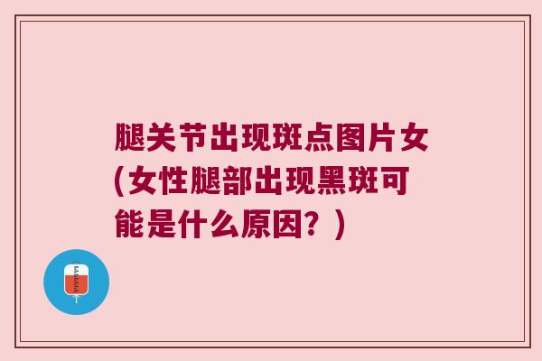 腿关节出现斑点图片女(女性腿部出现黑斑可能是什么原因？)