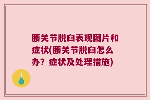腰关节脱臼表现图片和症状(腰关节脱臼怎么办？症状及处理措施)