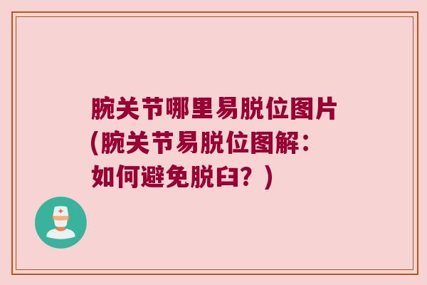 腕关节哪里易脱位图片(腕关节易脱位图解:如何避免脱臼?) 腕关节哪里易脱位图片(腕关节易脱位图解:如何避免脱臼?)