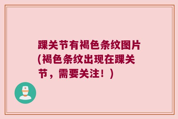 踝关节有褐色条纹图片(褐色条纹出现在踝关节,需要关注!) 踝关节有褐色条纹图片(褐色条纹出现在踝关节,需要关注!)