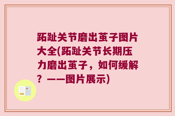 跖趾关节磨出茧子图片大全(跖趾关节长期压力磨出茧子,如何缓解?——图片展示) 跖趾关节磨出茧子图片大全(跖趾关节长期压力磨出茧子,如何缓解?——图片展示)