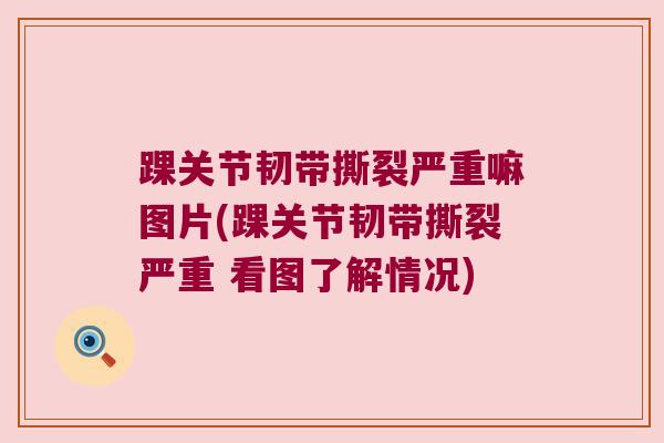 踝关节韧带撕裂严重嘛图片(踝关节韧带撕裂严重 看图了解情况) 踝关节韧带撕裂严重嘛图片(踝关节韧带撕裂严重 看图了解情况)