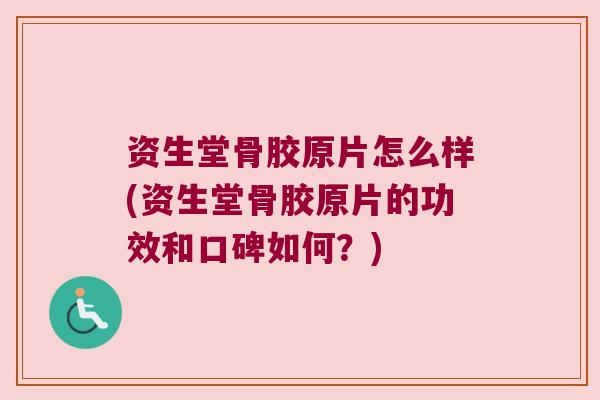资生堂骨胶原片怎么样(资生堂骨胶原片的功效和口碑如何?) 资生堂骨胶原片怎么样(资生堂骨胶原片的功效和口碑如何?)