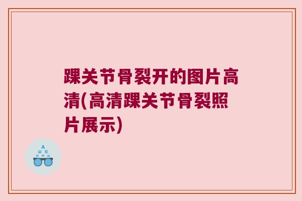 踝关节骨裂开的图片高清(高清踝关节骨裂照片展示)
