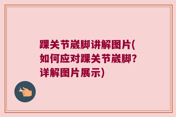 踝关节崴脚讲解图片(如何应对踝关节崴脚?详解图片展示) 踝关节崴脚讲解图片(如何应对踝关节崴脚?详解图片展示)