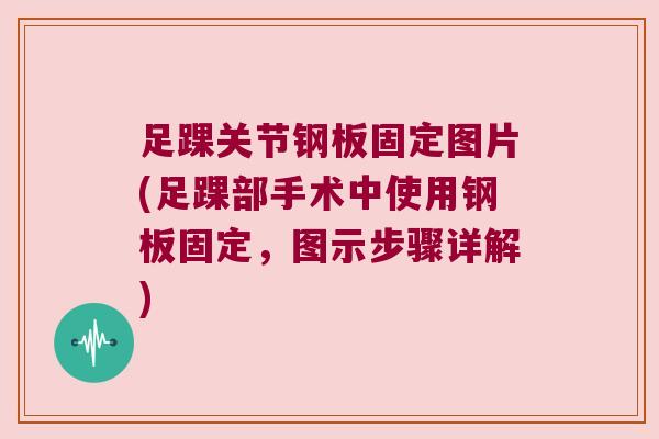 足踝关节钢板固定图片(足踝部手术中使用钢板固定,图示步骤详解) 足踝关节钢板固定图片(足踝部手术中使用钢板固定,图示步骤详解)